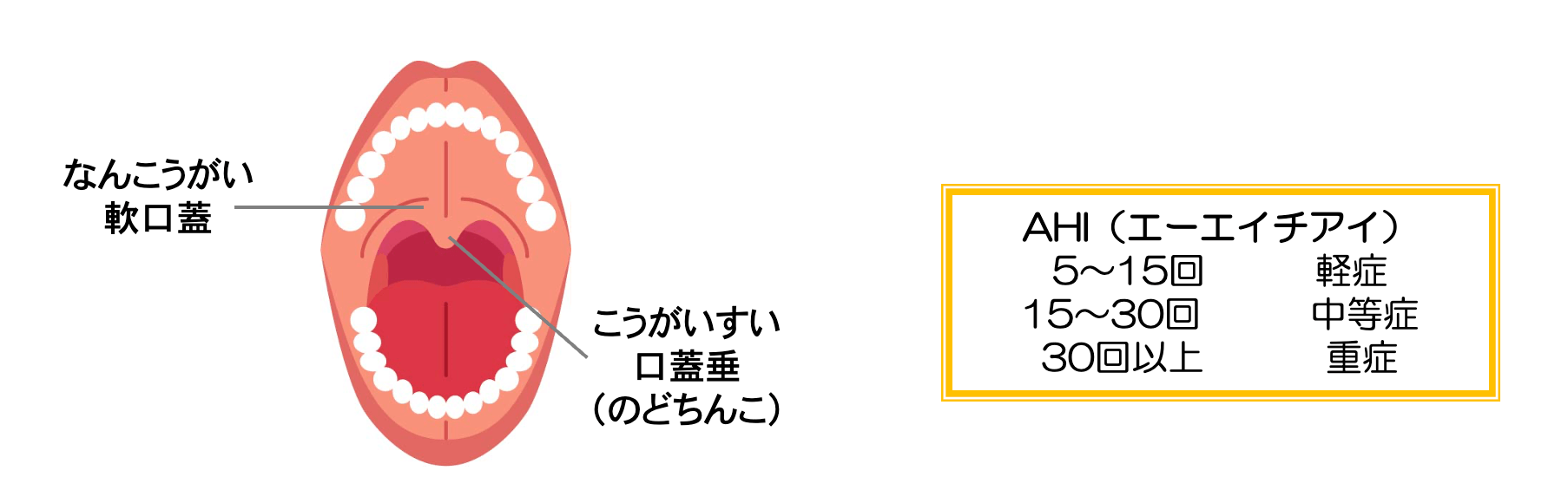 いびき 睡眠時無呼吸 治療と鼻づまり 大阪府豊中市細田耳鼻科